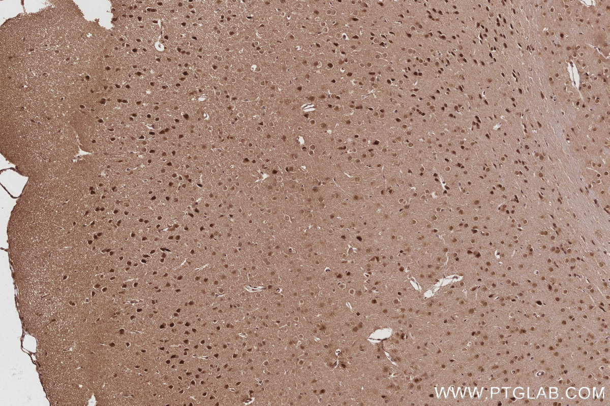 Immunohistochemical analysis of paraffin-embedded mouse brain tissue slide using KHC3020 (ANAPC7 IHC Kit).