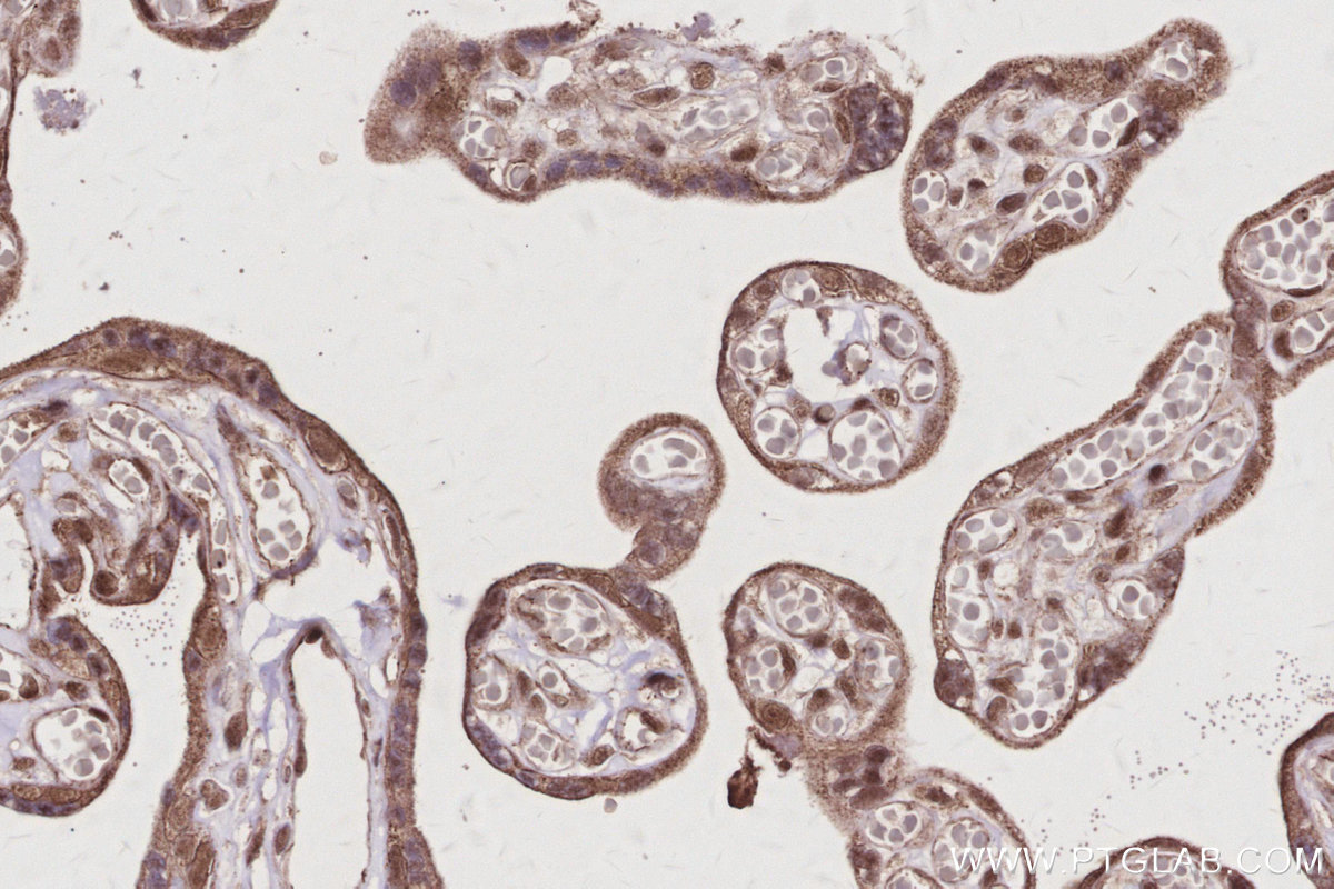 Immunohistochemical analysis of paraffin-embedded human placenta tissue slide using KHC3020 (ANAPC7 IHC Kit).