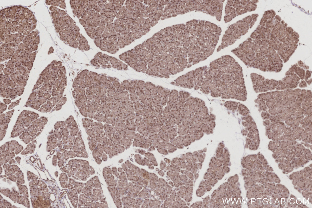Immunohistochemical analysis of paraffin-embedded rat pancreas tissue slide using KHC3020 (ANAPC7 IHC Kit).