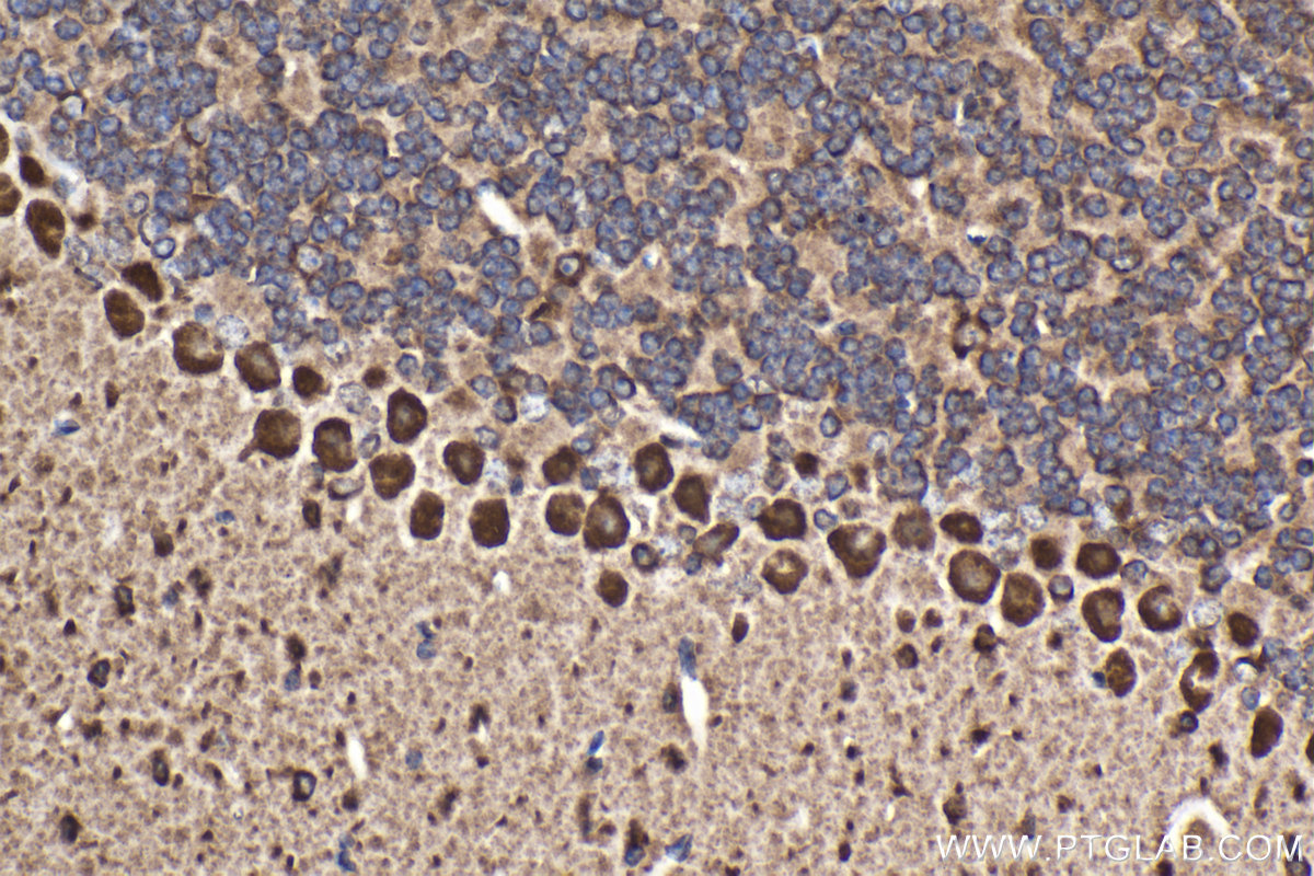 Immunohistochemical analysis of paraffin-embedded mouse cerebellum tissue slide using KHC2108 (ANKRD17 IHC Kit).