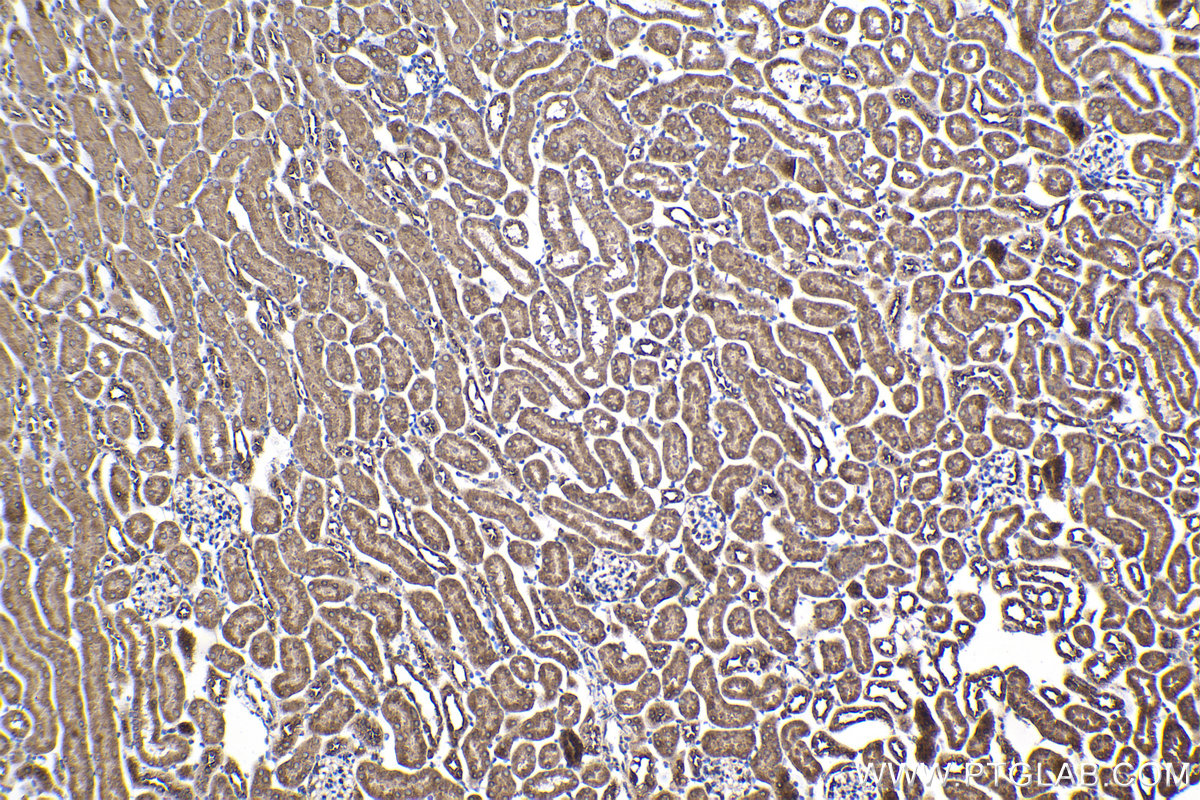 Immunohistochemical analysis of paraffin-embedded mouse kidney tissue slide using KHC2108 (ANKRD17 IHC Kit).