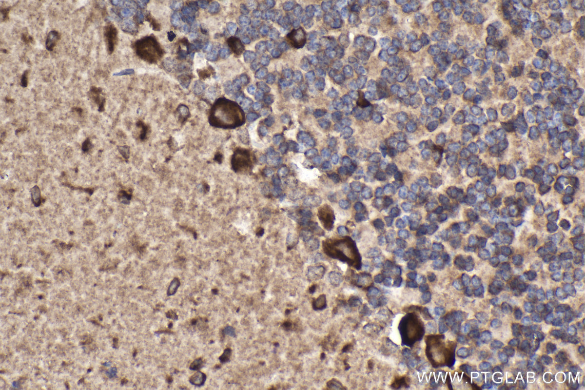 Immunohistochemical analysis of paraffin-embedded rat cerebellum tissue slide using KHC2108 (ANKRD17 IHC Kit).