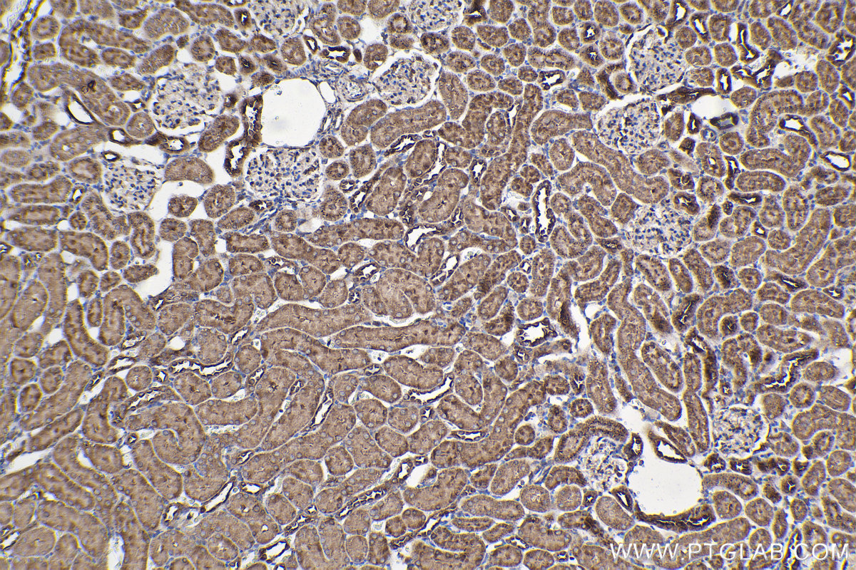 Immunohistochemical analysis of paraffin-embedded rat kidney tissue slide using KHC2108 (ANKRD17 IHC Kit).
