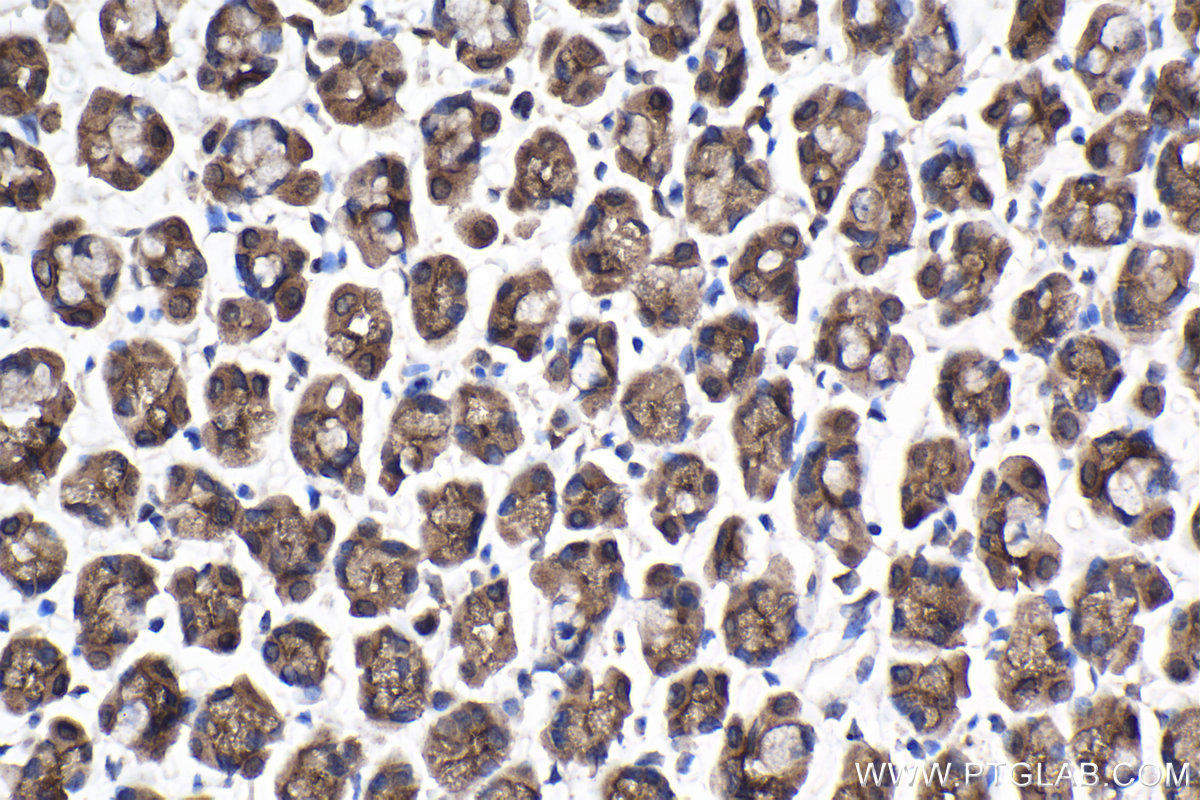 Immunohistochemical analysis of paraffin-embedded rat stomach tissue slide using KHC2108 (ANKRD17 IHC Kit).