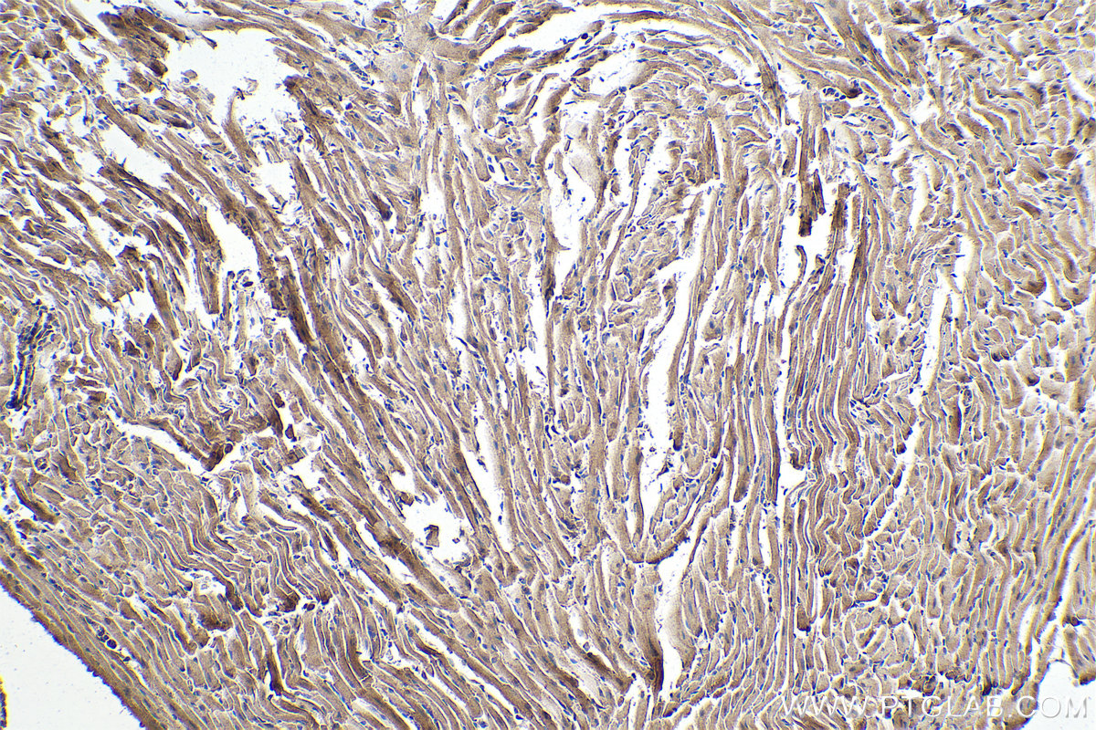 Immunohistochemical analysis of paraffin-embedded mouse heart tissue slide using KHC0331 (ANKRD2 IHC Kit).