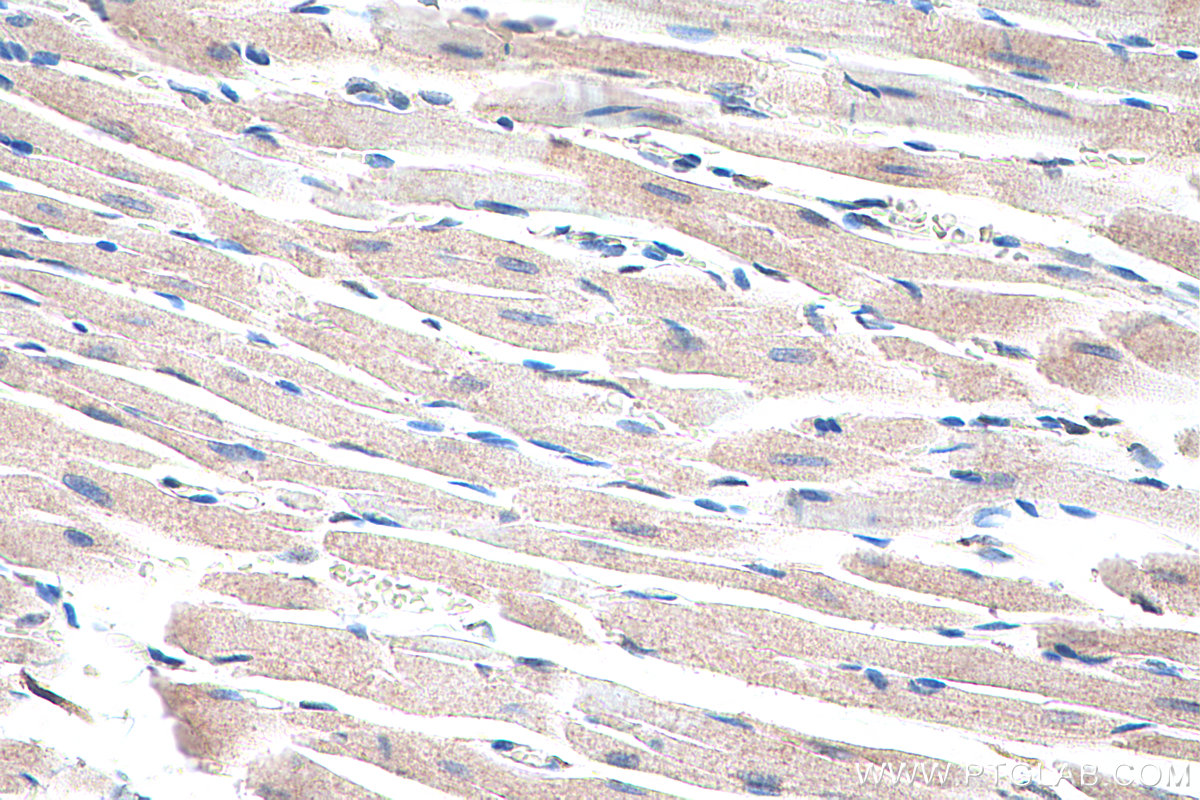 Immunohistochemical analysis of paraffin-embedded rat heart tissue slide using KHC0331 (ANKRD2 IHC Kit).