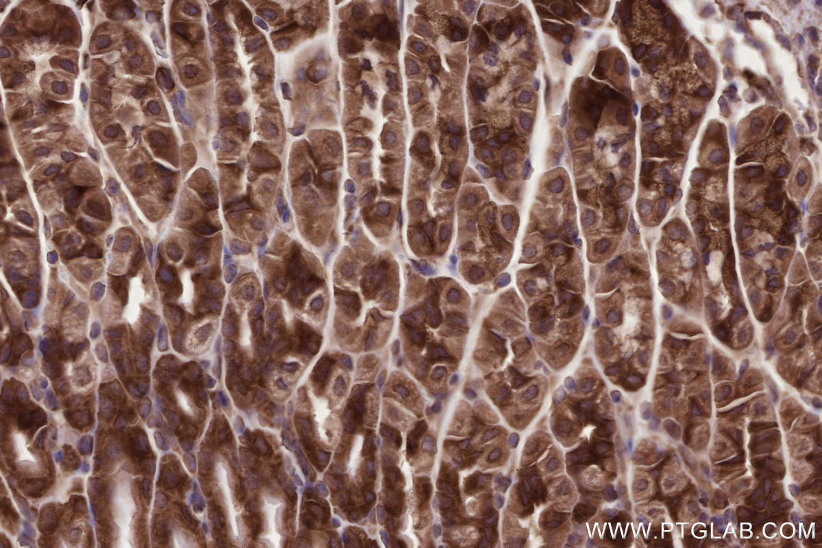 Immunohistochemical analysis of paraffin-embedded mouse stomach tissue slide using KHC2682 (ANKRD53 IHC Kit).