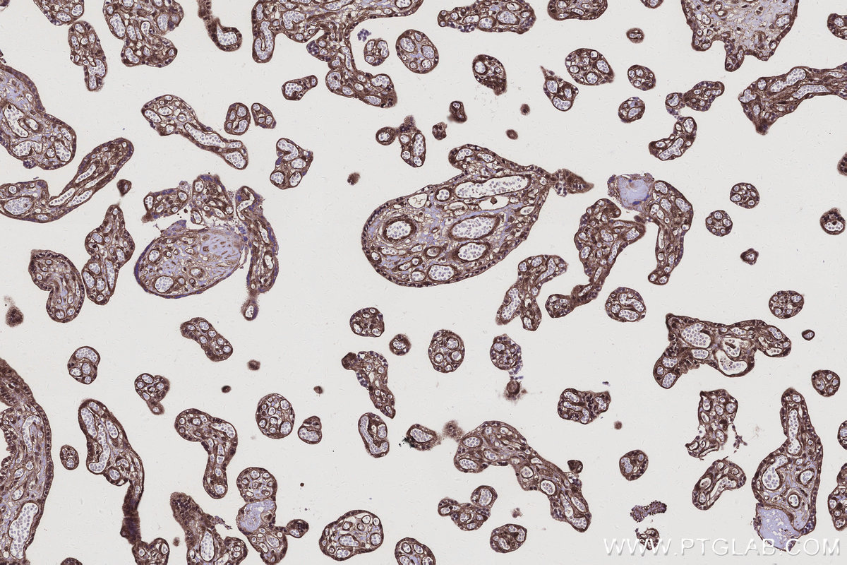 Immunohistochemical analysis of paraffin-embedded human placenta tissue slide using KHC3104 (ANKRD54 IHC Kit). Immunohistochemical analysis of paraffin-embedded human placenta tissue slide using KHC3104 (ANKRD54 IHC Kit).