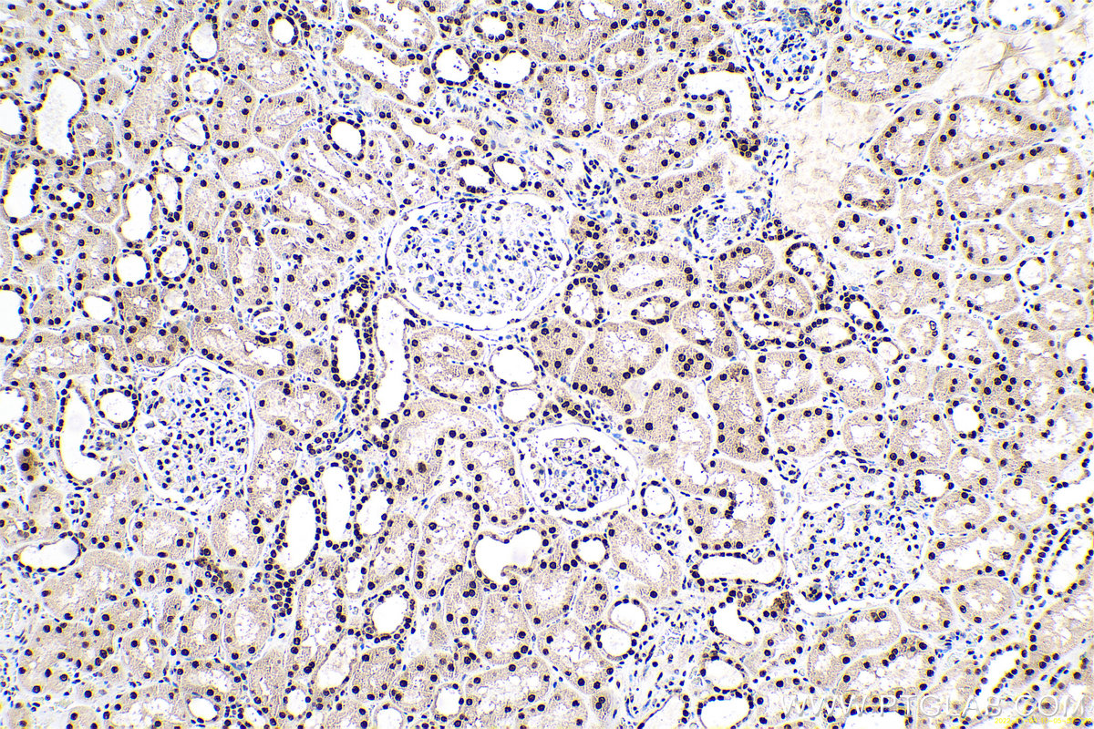 Immunohistochemical analysis of paraffin-embedded human kidney tissue slide using KHC0670 (ANP32A IHC Kit).