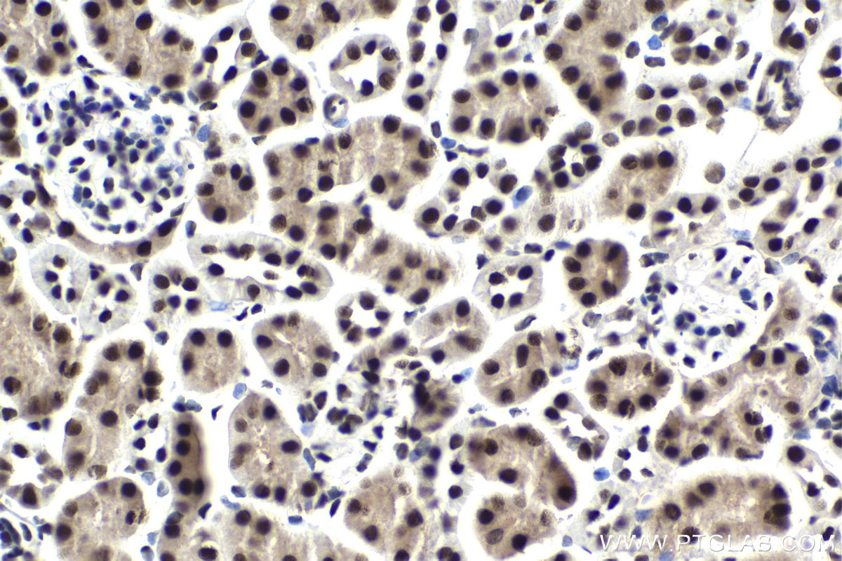 Immunohistochemical analysis of paraffin-embedded mouse kidney tissue slide using KHC1850 (ANP32B IHC Kit).