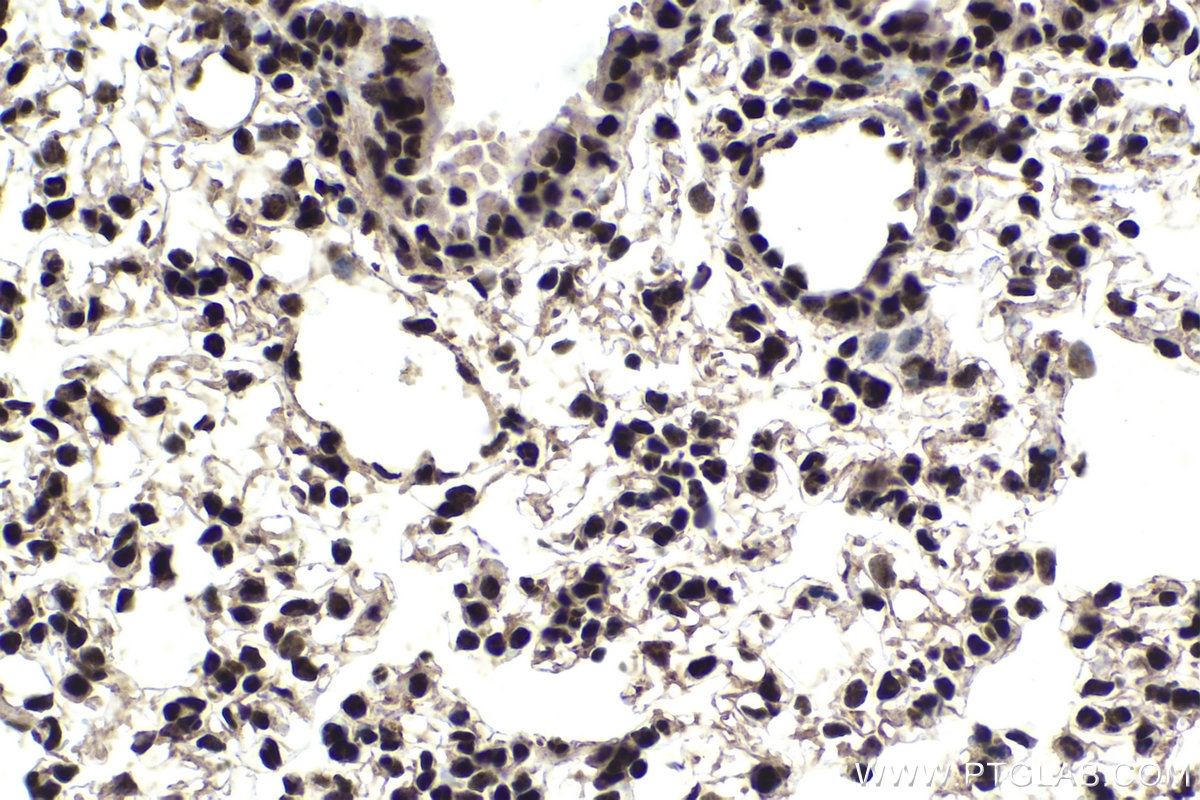 Immunohistochemical analysis of paraffin-embedded mouse lung tissue slide using KHC1850 (ANP32B IHC Kit).