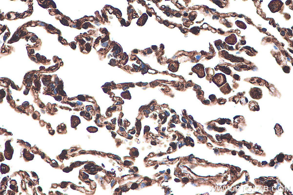 Immunohistochemical analysis of paraffin-embedded human lung tissue slide using KHC0399 (ANXA1 IHC Kit).