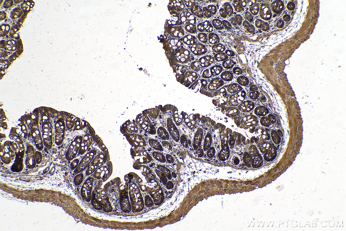 Immunohistochemical analysis of paraffin-embedded mouse colon tissue slide using KHC0708 (ANXA11 IHC Kit).