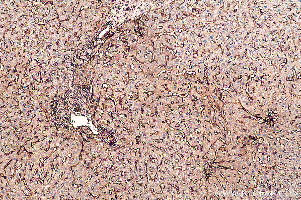 Immunohistochemical analysis of paraffin-embedded human liver tissue slide using KHC0396 (ANXA2 IHC Kit).