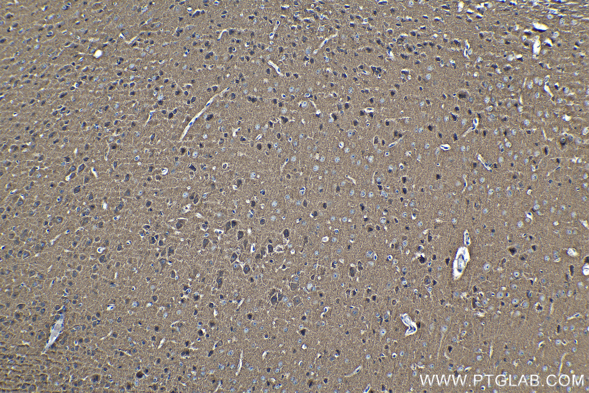 Immunohistochemical analysis of paraffin-embedded mouse brain tissue slide using KHC1273 (AP2A1 IHC Kit).