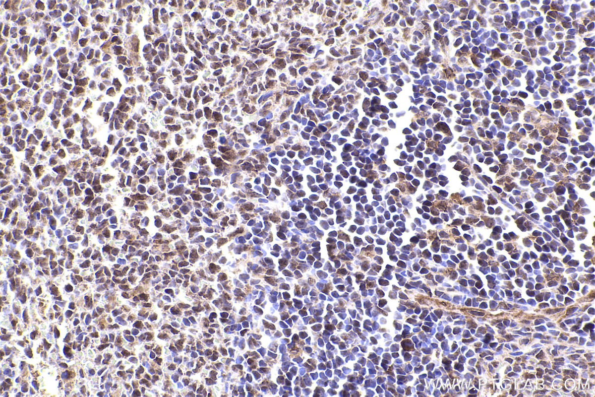 Immunohistochemical analysis of paraffin-embedded rat spleen tissue slide using KHC2387 (APBA1 IHC Kit).
