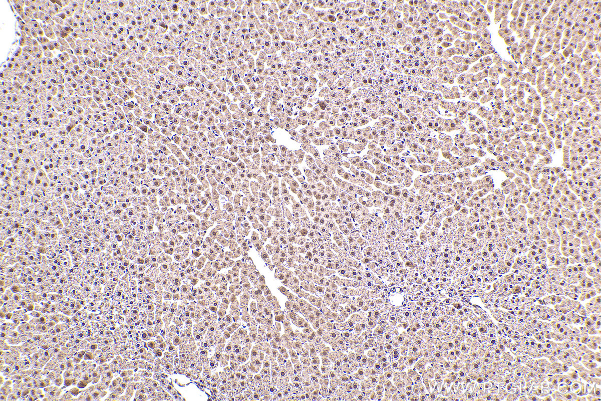 Immunohistochemical analysis of paraffin-embedded rat liver tissue slide using KHC2387 (APBA1 IHC Kit).
