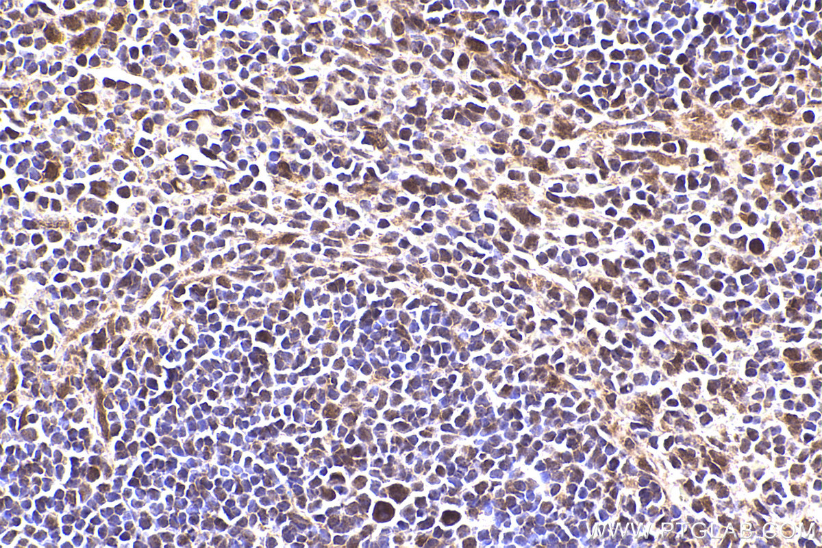 Immunohistochemical analysis of paraffin-embedded mouse spleen tissue slide using KHC2387 (APBA1 IHC Kit).