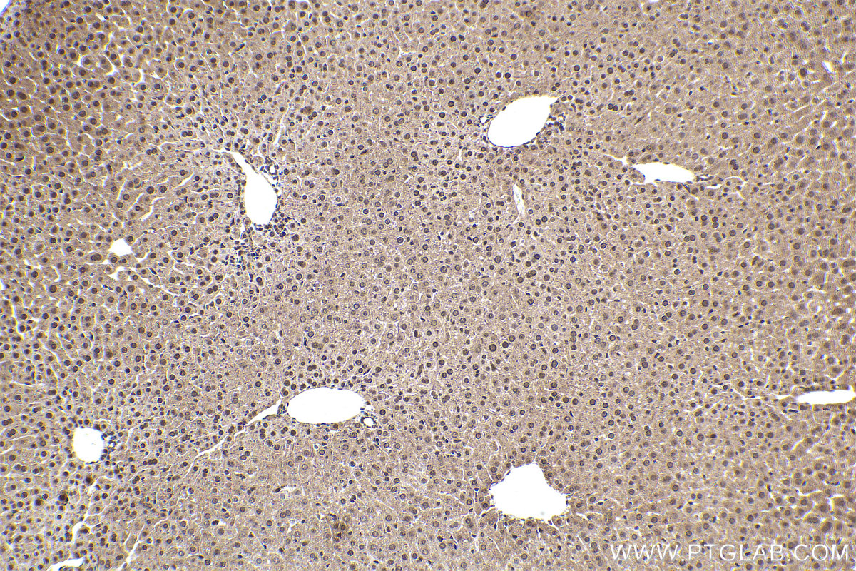 Immunohistochemical analysis of paraffin-embedded mouse liver tissue slide using KHC2387 (APBA1 IHC Kit).