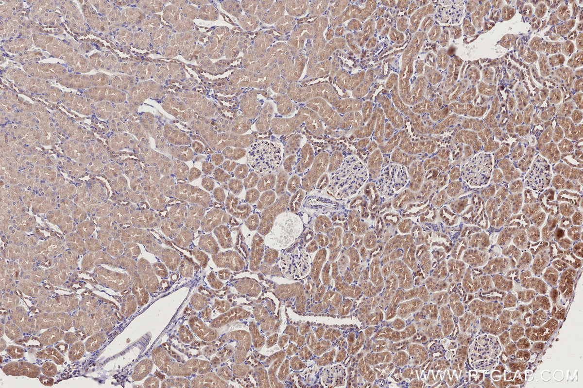 Immunohistochemical analysis of paraffin-embedded rat kidney tissue slide using KHC2762 (APBB2 IHC Kit).
