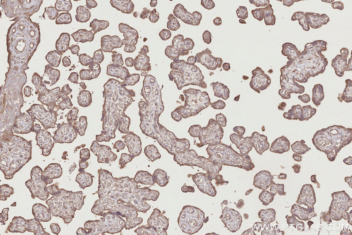 Immunohistochemical analysis of paraffin-embedded human placenta tissue slide using KHC2762 (APBB2 IHC Kit).