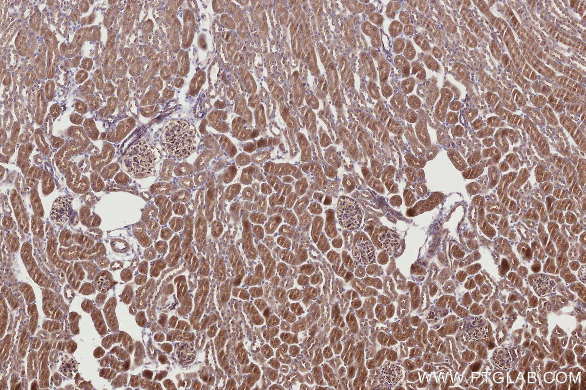 Immunohistochemical analysis of paraffin-embedded mouse kidney tissue slide using KHC2762 (APBB2 IHC Kit).