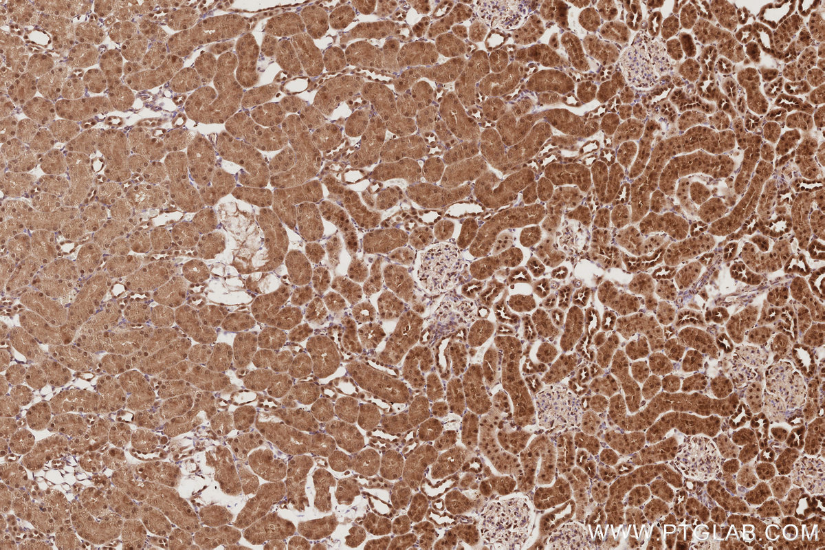 Immunohistochemical analysis of paraffin-embedded rat kidney tissue slide using KHC2902 (APC1 IHC Kit).