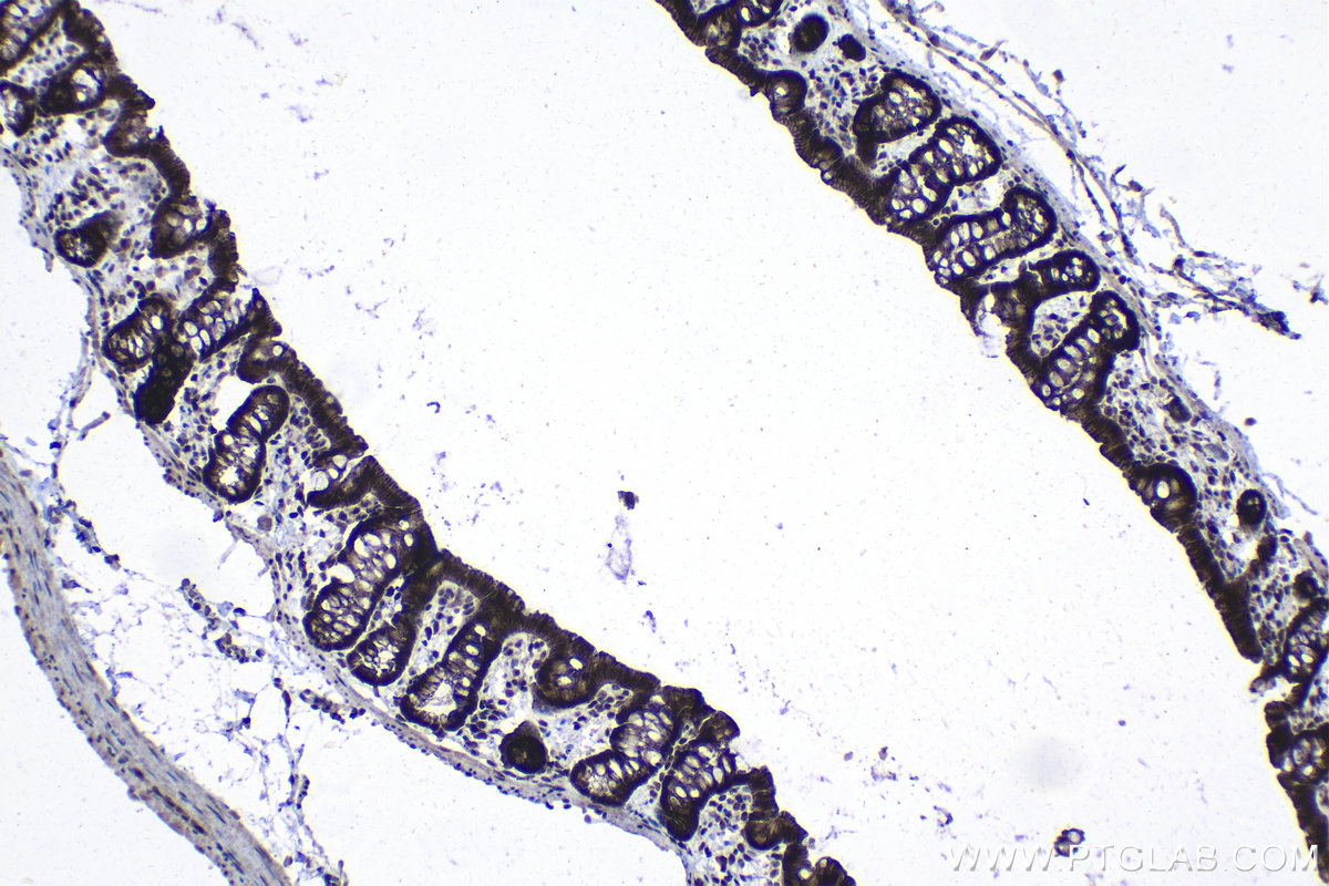 Immunohistochemical analysis of paraffin-embedded rat colon tissue slide using KHC1351 (APC2 IHC Kit).