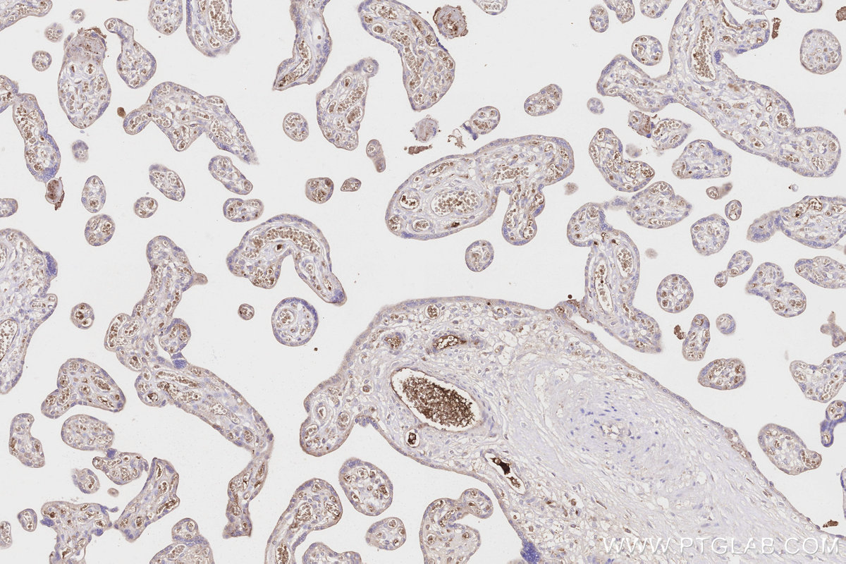 Immunohistochemical analysis of paraffin-embedded human placenta tissue slide using KHC3245 (APOA4 IHC Kit). Immunohistochemical analysis of paraffin-embedded human placenta tissue slide using KHC3245 (APOA4 IHC Kit).
