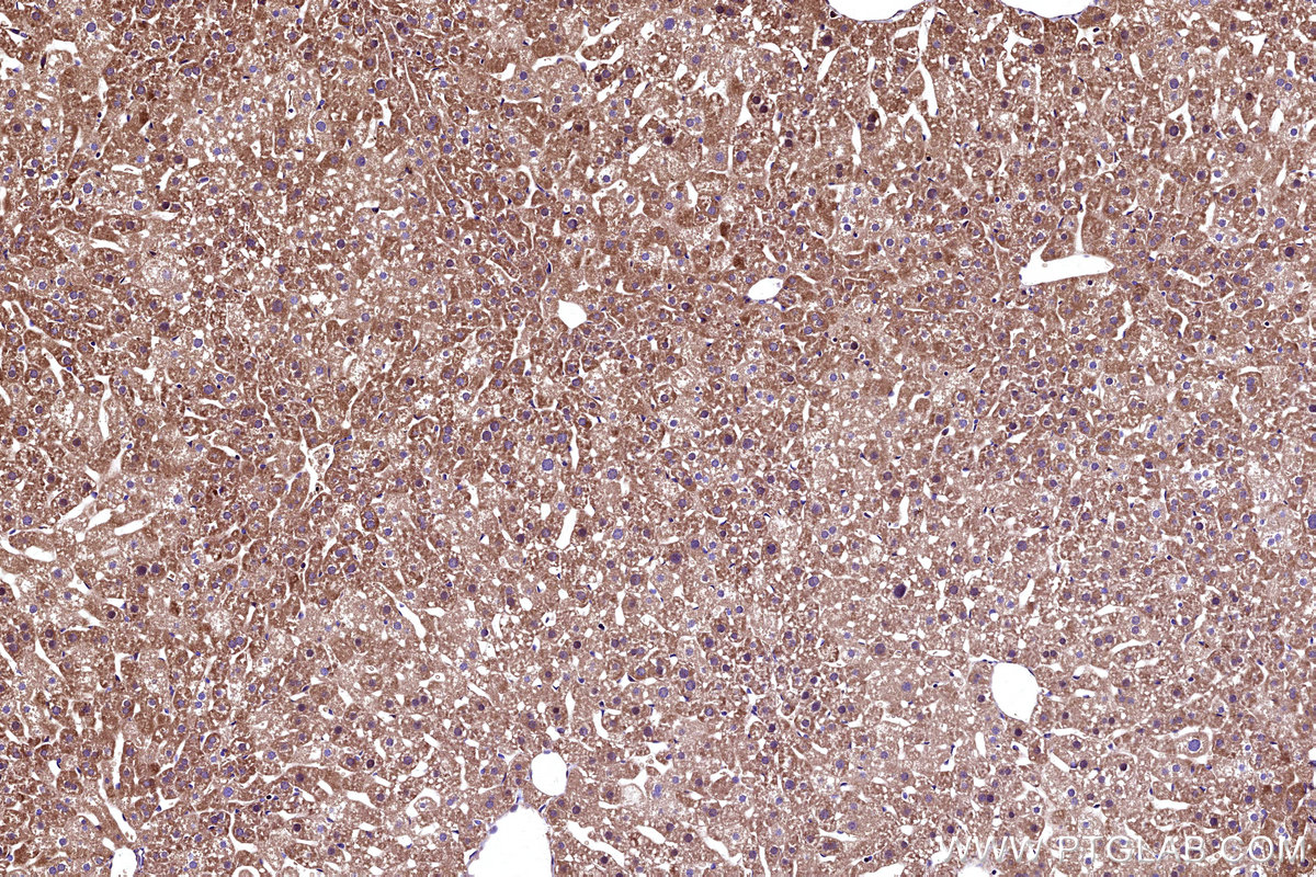 Immunohistochemical analysis of paraffin-embedded mouse liver tissue slide using KHC3167 (APOB IHC Kit).