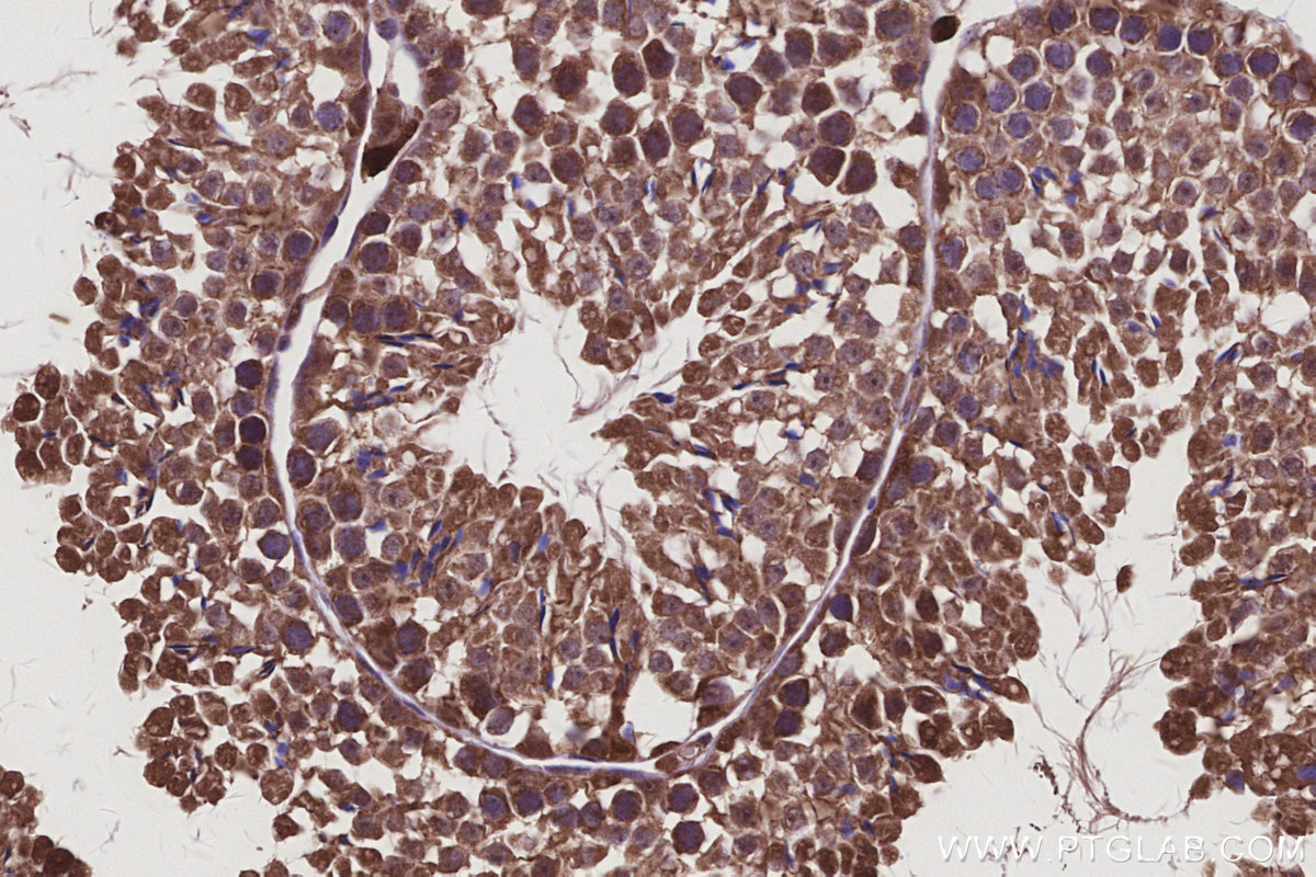 Immunohistochemical analysis of paraffin-embedded mouse testis tissue slide using KHC3108 (APOBEC4 IHC Kit).