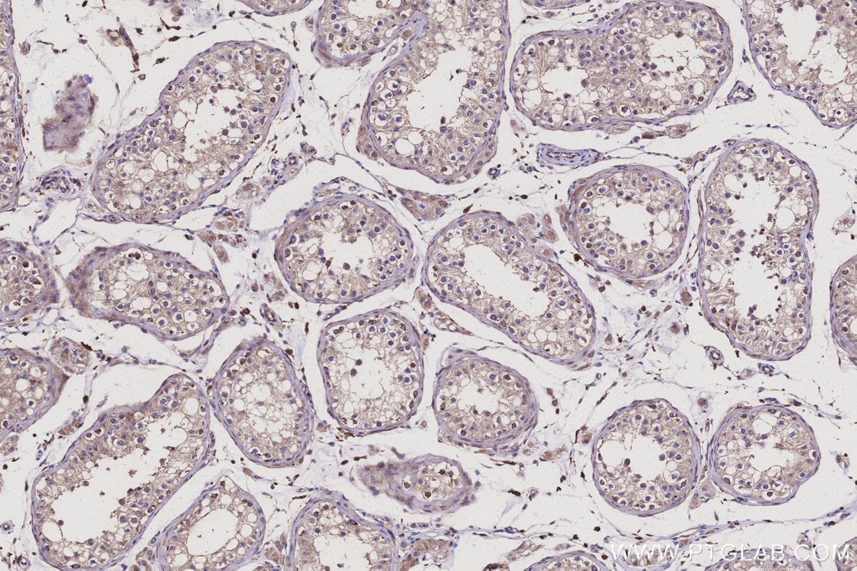 Immunohistochemical analysis of paraffin-embedded human testis tissue slide using KHC3108 (APOBEC4 IHC Kit).