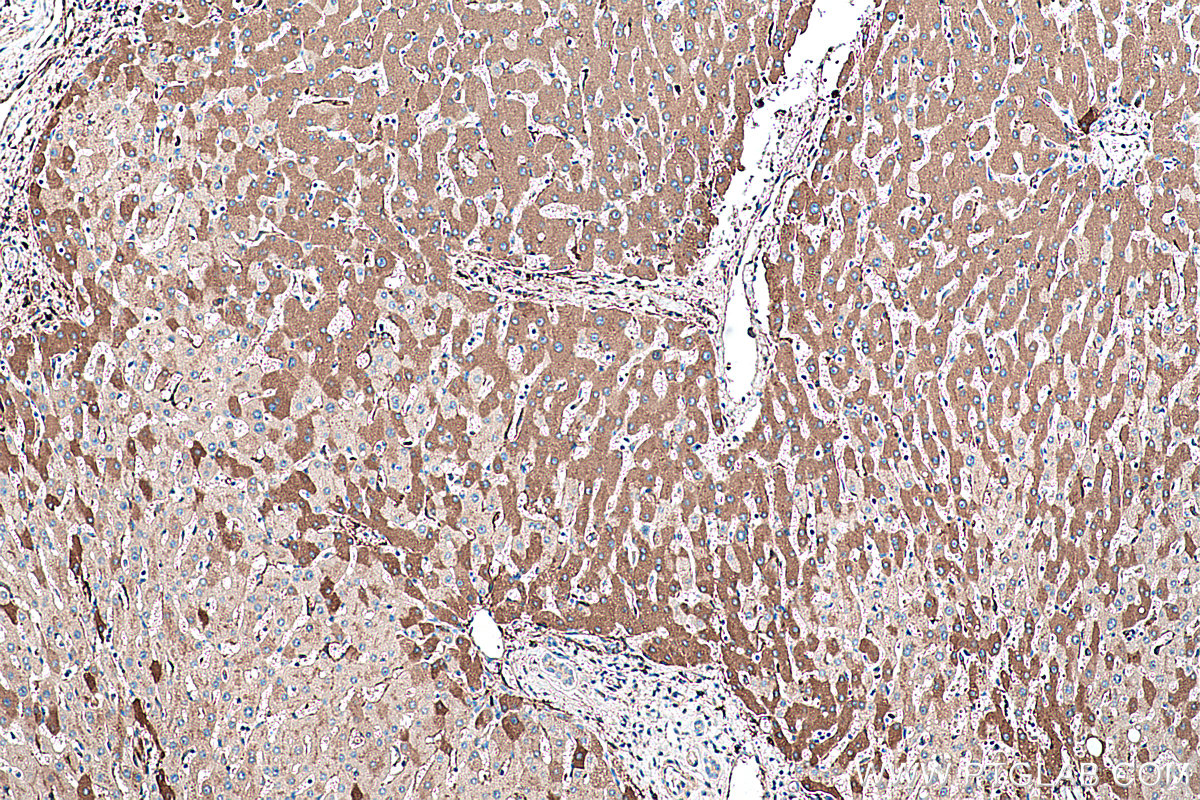 Immunohistochemical analysis of paraffin-embedded human liver tissue slide using KHC0382 (APOH IHC Kit).