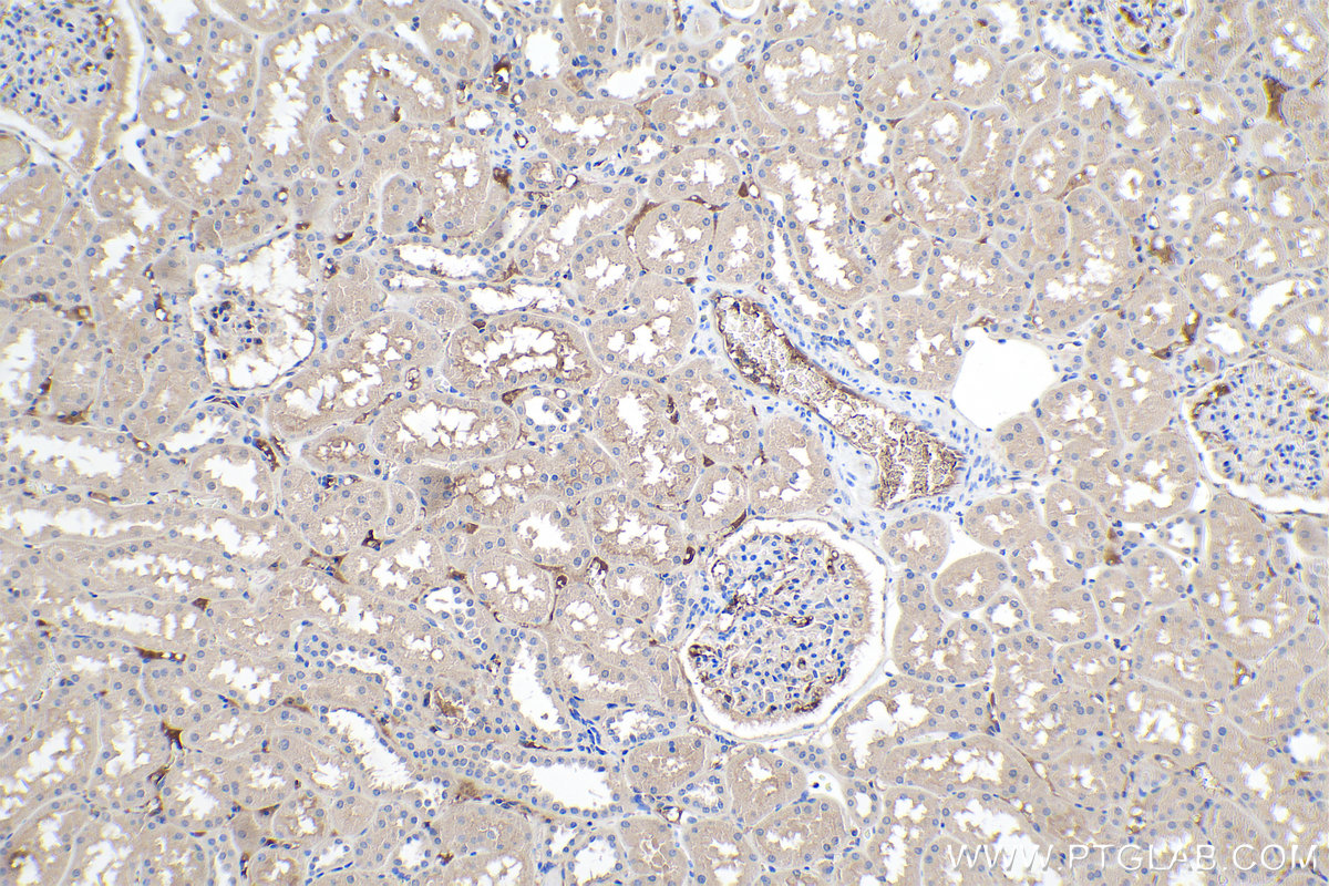 Immunohistochemical analysis of paraffin-embedded human kidney tissue slide using KHC0223 (APOL1 IHC Kit).