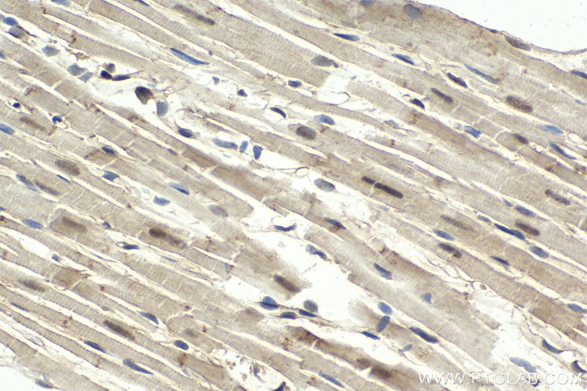 Immunohistochemical analysis of paraffin-embedded rat heart tissue slide using KHC1992 (APPL1 IHC Kit).