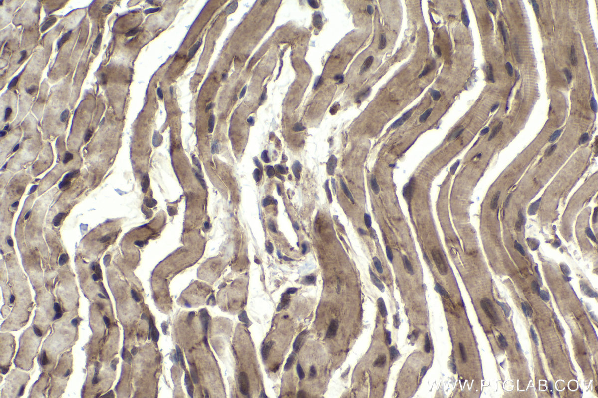 Immunohistochemical analysis of paraffin-embedded mouse heart tissue slide using KHC1992 (APPL1 IHC Kit).