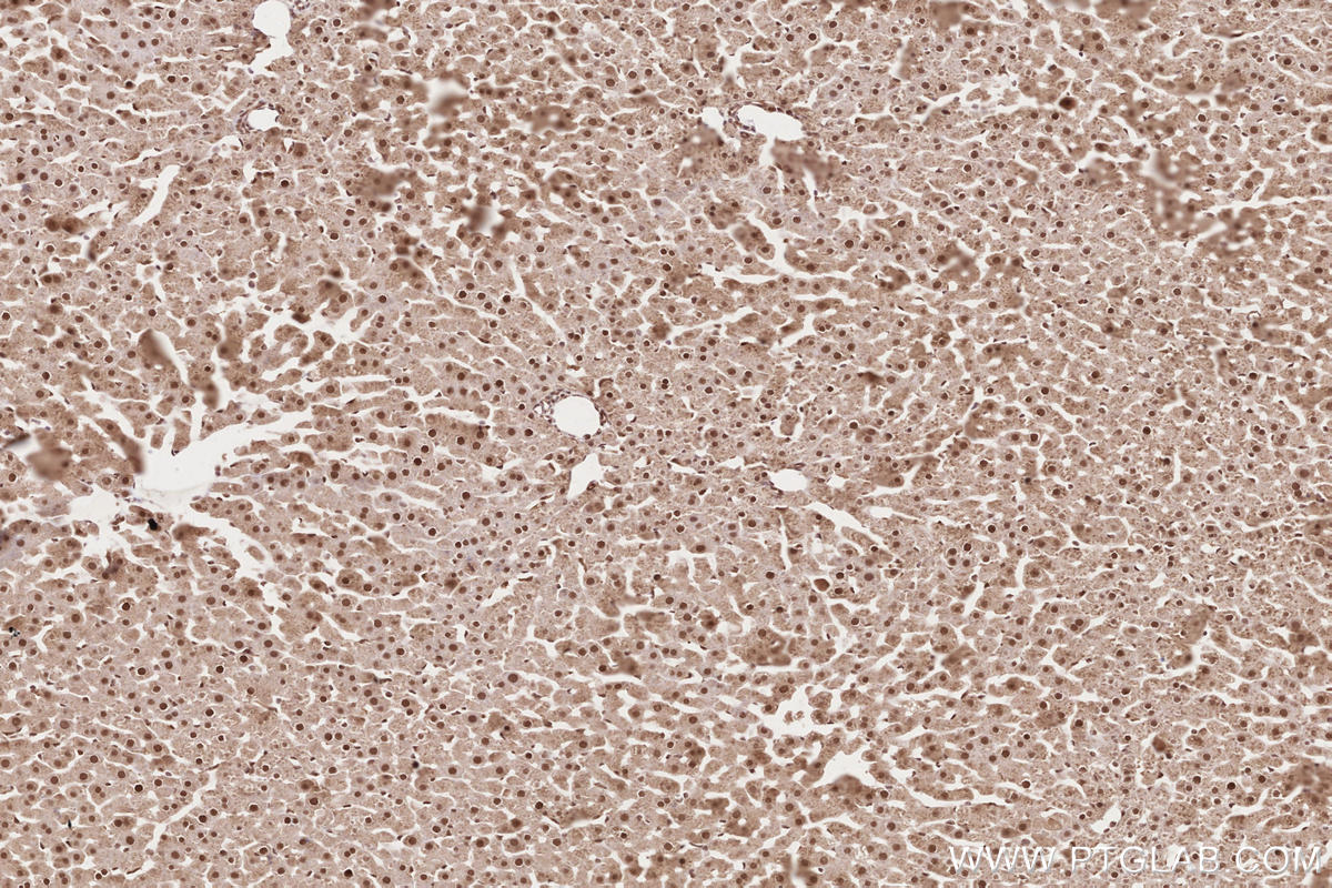 Immunohistochemical analysis of paraffin-embedded rat liver tissue slide using KHC2617 (APTX IHC Kit).