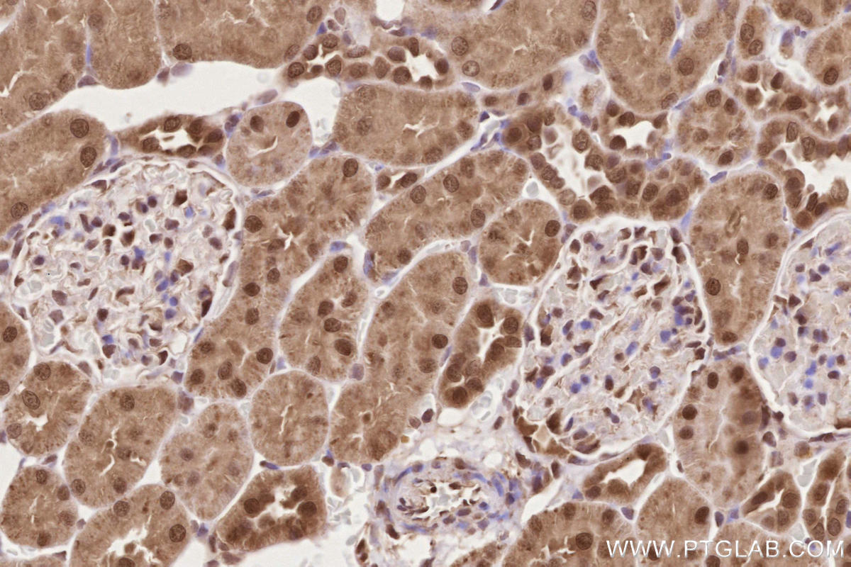 Immunohistochemical analysis of paraffin-embedded rat kidney tissue slide using KHC2617 (APTX IHC Kit).