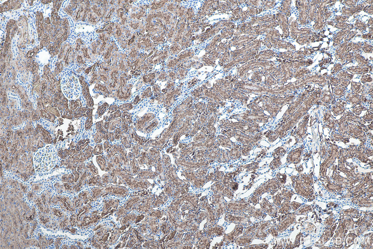 Immunohistochemical analysis of paraffin-embedded rat kidney tissue slide using KHC0083 (AQP1 IHC Kit).