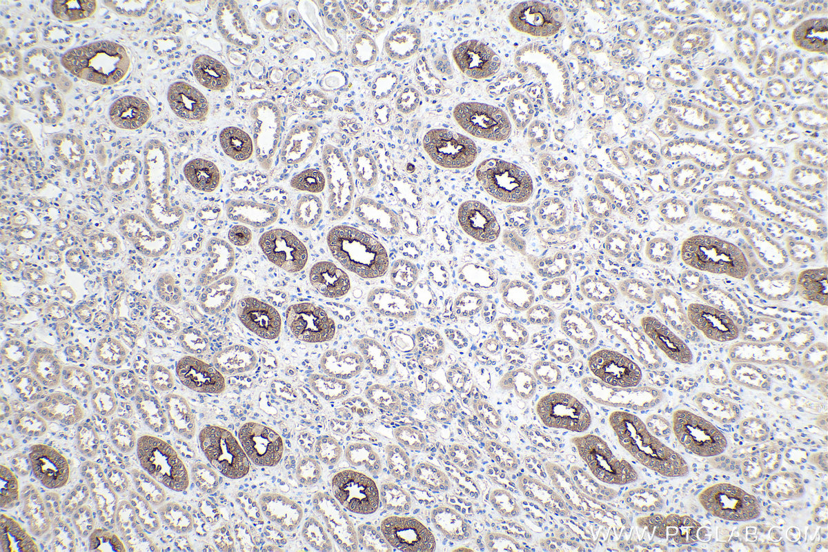 Immunohistochemical analysis of paraffin-embedded human kidney tissue slide using KHC0198 (AQP2 IHC Kit).