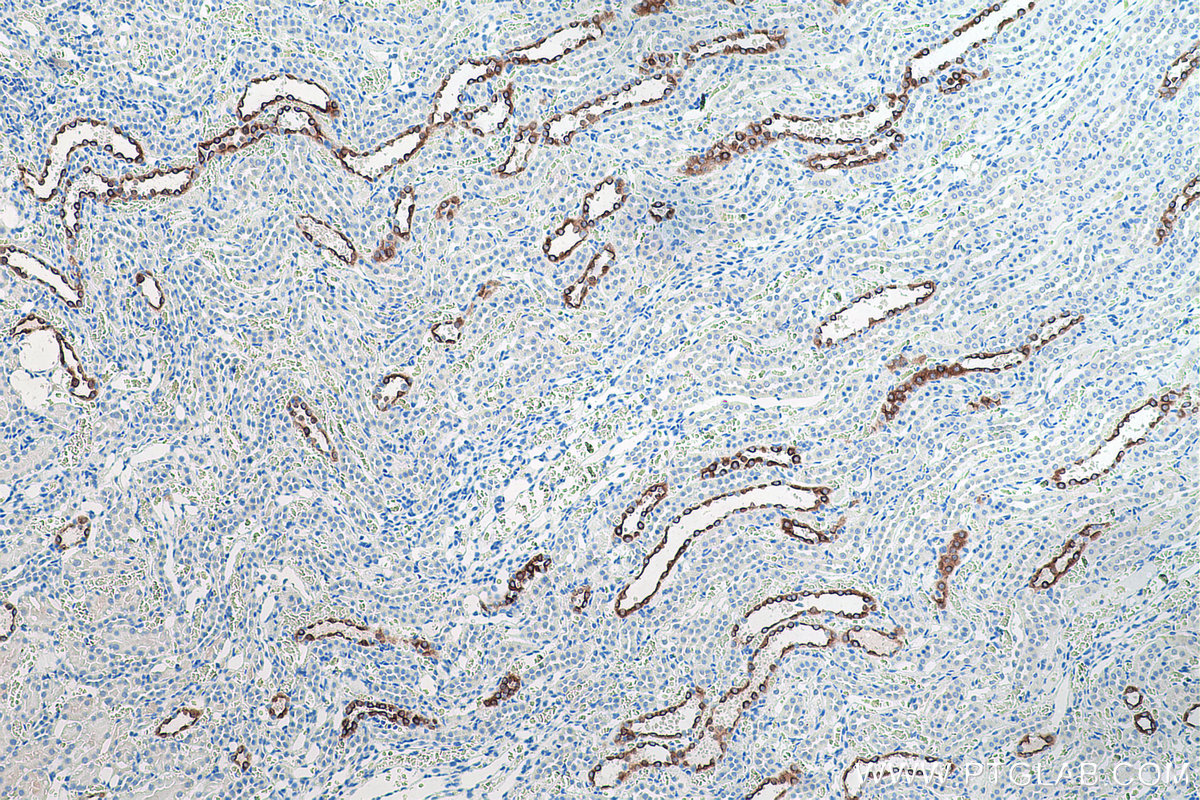 Immunohistochemical analysis of paraffin-embedded rat kidney tissue slide using KHC0198 (AQP2 IHC Kit).