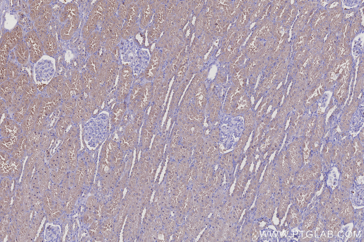 Immunohistochemical analysis of paraffin-embedded human kidney tissue slide using KHC3109 (ARAP2 IHC Kit). Immunohistochemical analysis of paraffin-embedded human kidney tissue slide using KHC3109 (ARAP2 IHC Kit).