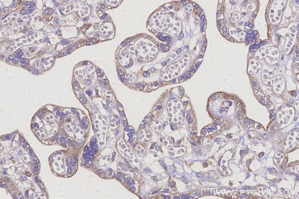 Immunohistochemical analysis of paraffin-embedded human placenta tissue slide using KHC3109 (ARAP2 IHC Kit). Immunohistochemical analysis of paraffin-embedded human placenta tissue slide using KHC3109 (ARAP2 IHC Kit).