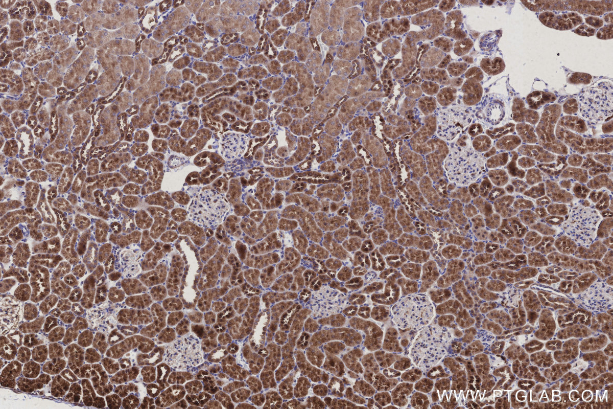 Immunohistochemical analysis of paraffin-embedded rat kidney tissue slide using KHC3109 (ARAP2 IHC Kit). Immunohistochemical analysis of paraffin-embedded rat kidney tissue slide using KHC3109 (ARAP2 IHC Kit).