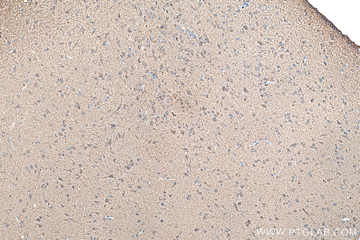 Immunohistochemical analysis of paraffin-embedded rat brain tissue slide using KHC0757 (ARC IHC Kit).