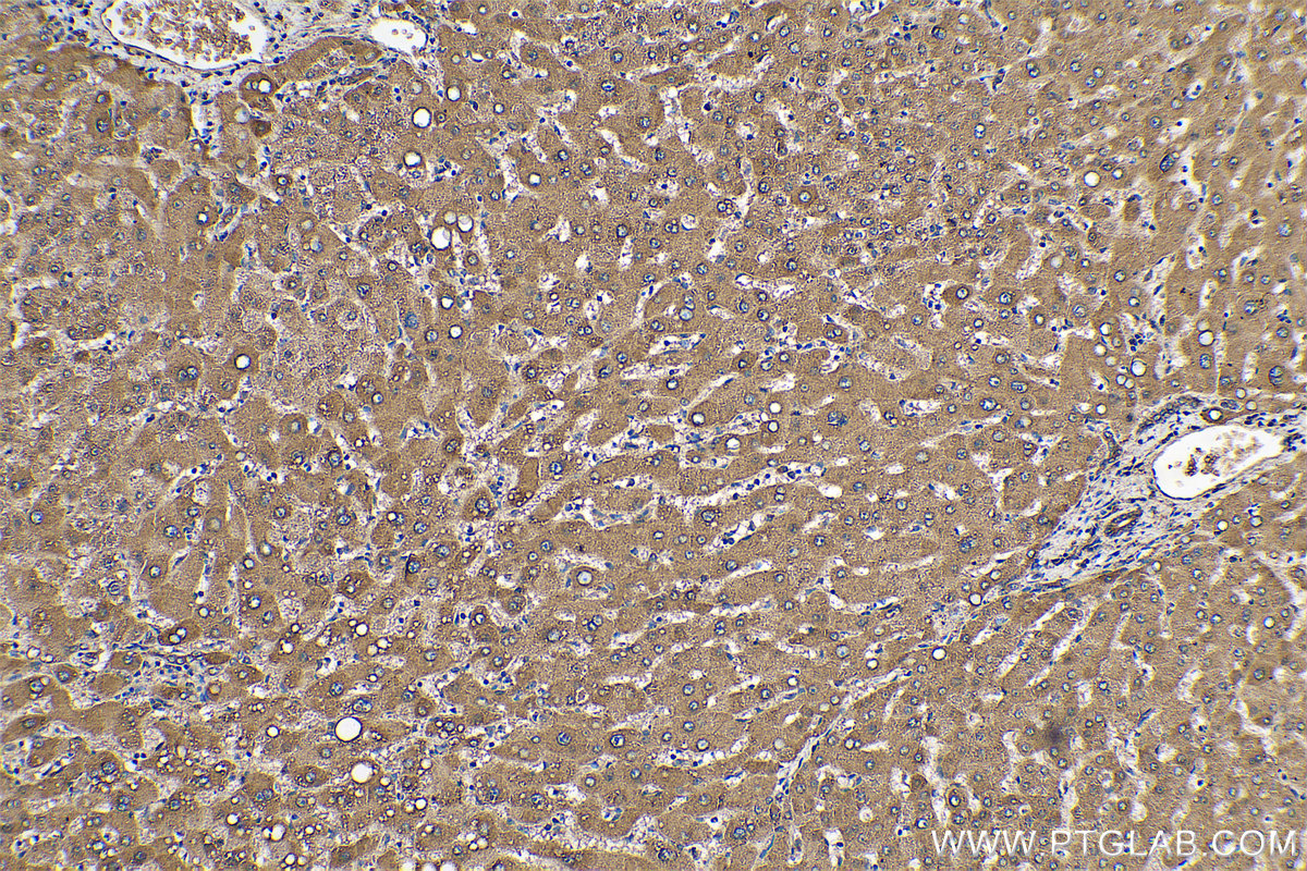 Immunohistochemical analysis of paraffin-embedded human liver tissue slide using KHC0721 (ARF4 IHC Kit).