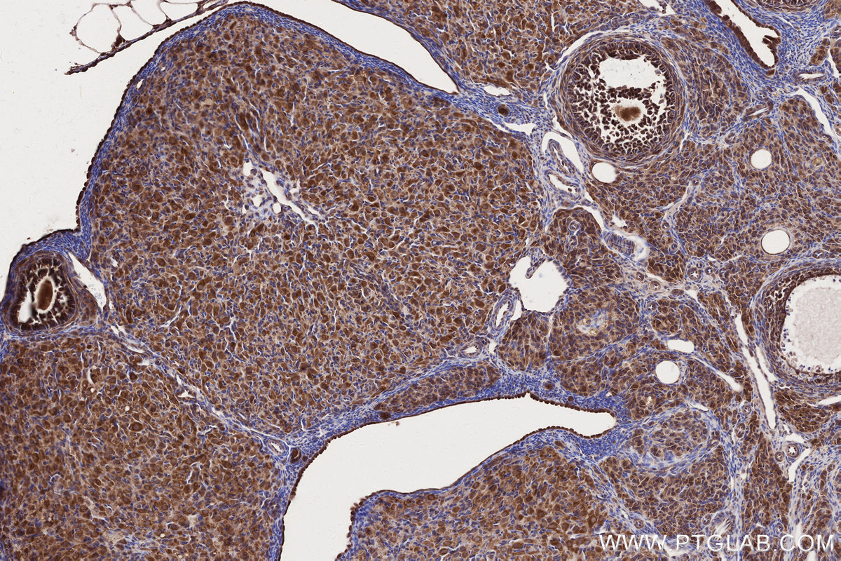 Immunohistochemical analysis of paraffin-embedded rat ovary tissue slide using KHC2679 (ARFGAP2 IHC Kit).