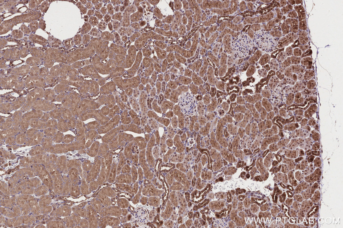 Immunohistochemical analysis of paraffin-embedded rat kidney tissue slide using KHC2679 (ARFGAP2 IHC Kit).