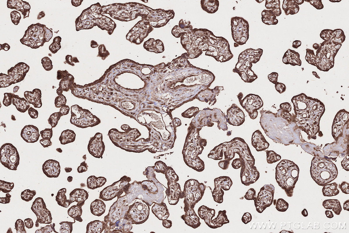 Immunohistochemical analysis of paraffin-embedded human placenta tissue slide using KHC2679 (ARFGAP2 IHC Kit).