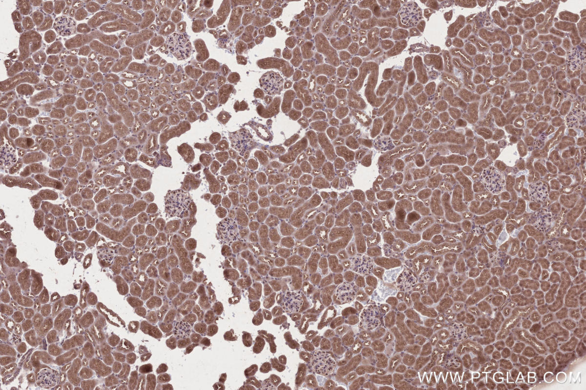 Immunohistochemical analysis of paraffin-embedded mouse kidney tissue slide using KHC2679 (ARFGAP2 IHC Kit).